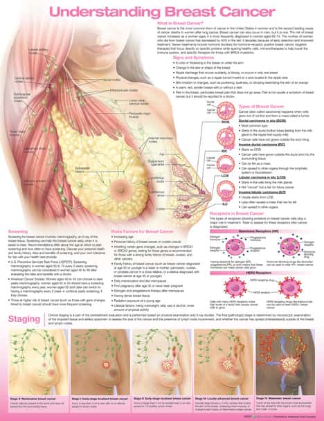 Understanding Breast Cancer Laminated Anatomical Chart - 4th Edition