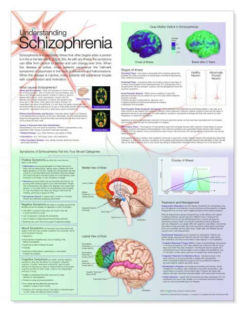 Understanding Schizophrenia Laminated Anatomical Chart