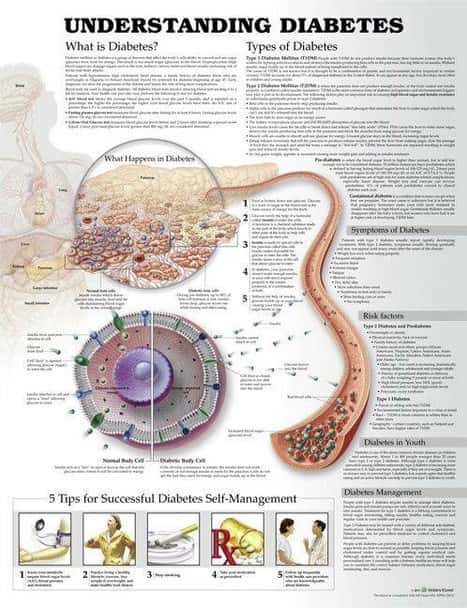 Understanding Diabetes Laminated Anatomical Chart - 3rd Edition