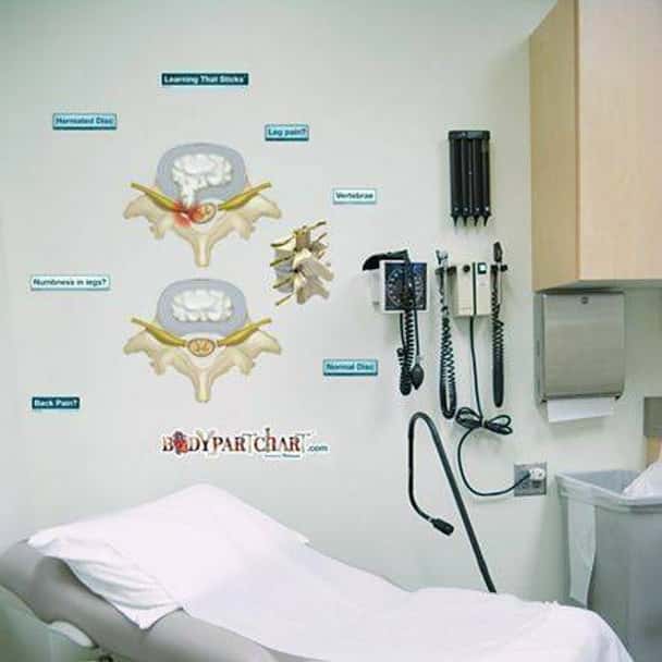 Prolapsed Disc Anatomy Dry-Erase Sticky Wall Chart - 27 in x 40 in