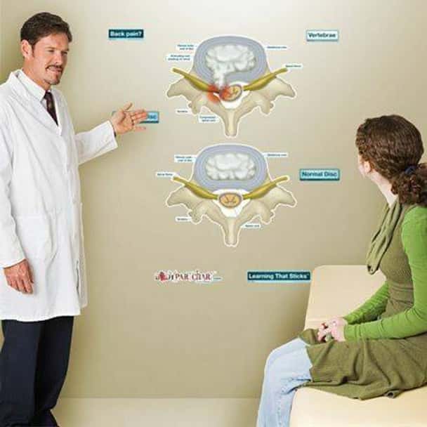 Prolapsed Disc Anatomy Dry-Erase Sticky Wall Chart - Labeled