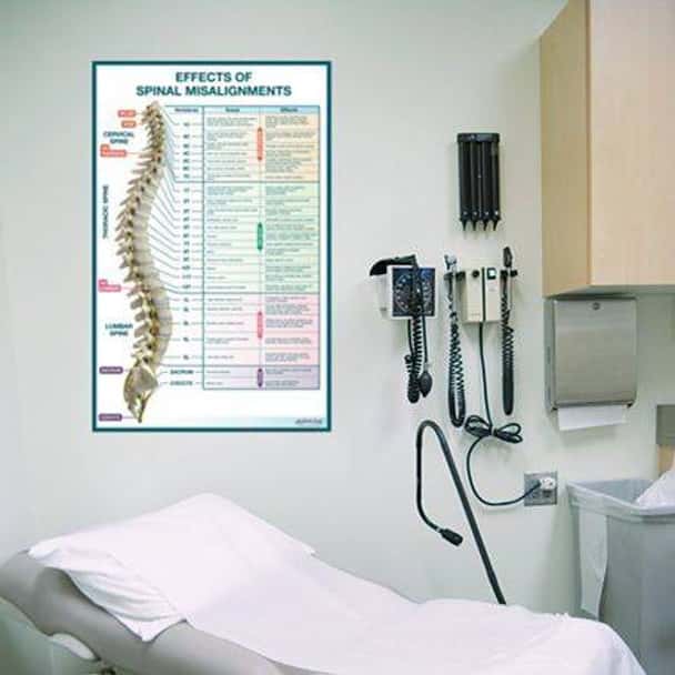 Effects of Spinal Misalignments Anatomy Dry-Erase Sticky Wall Chart