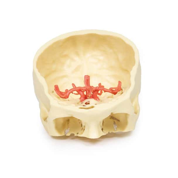 3D printed circle of willis. Full view. Exposed arteries.
