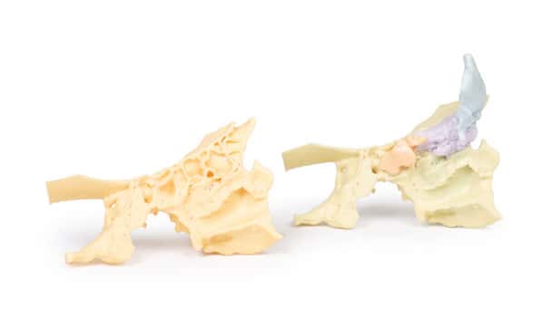 3D Printed Paranasal Sinus Model