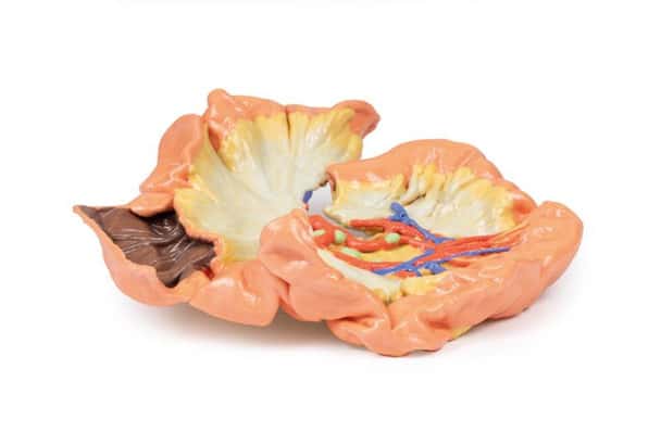 3D printed portion of jejenum. Full view. Exposed arteries.