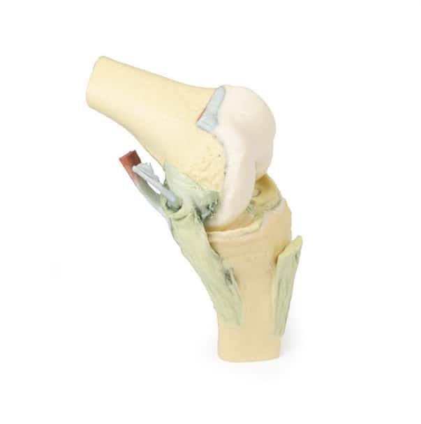 3D printed knee joint. Full view. No skin. Exposed ligaments.