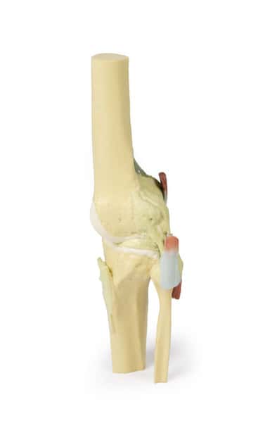 3D printed knee joint. Full view. No skin. Exposed ligaments.