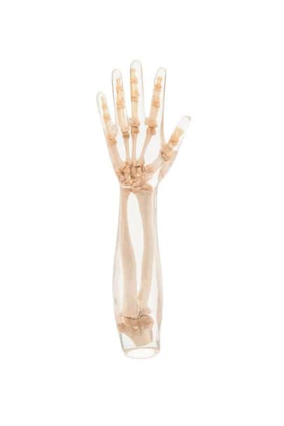 X-Ray Phantom Lower Arm, Transparent