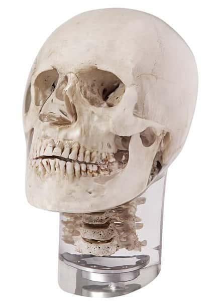X-Ray Phantom Head With Cervical Vertebrae, Transparent