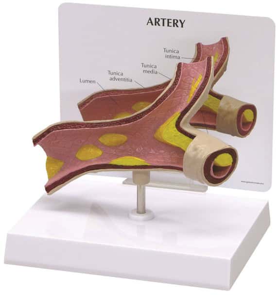 Artery Section Anatomy Model