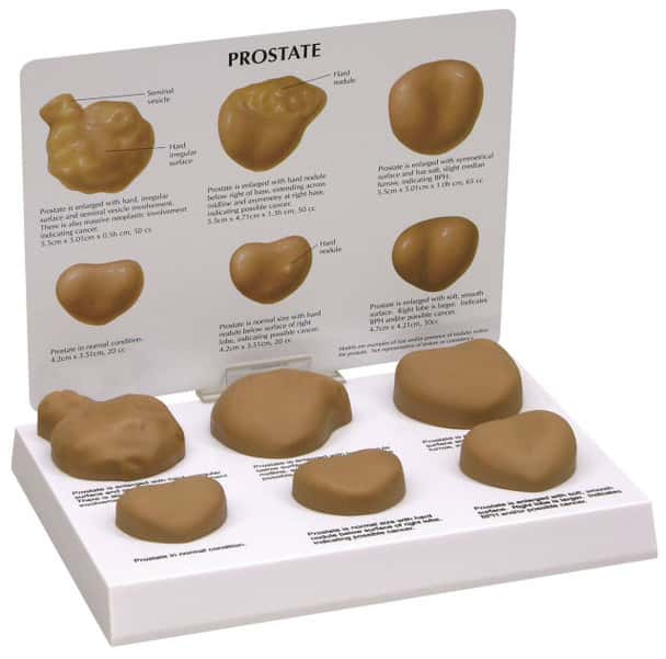 Life-Size Prostate Anatomy Model Set