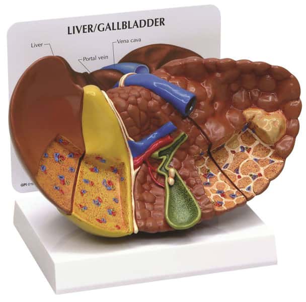 Diseased Liver Anatomy Model