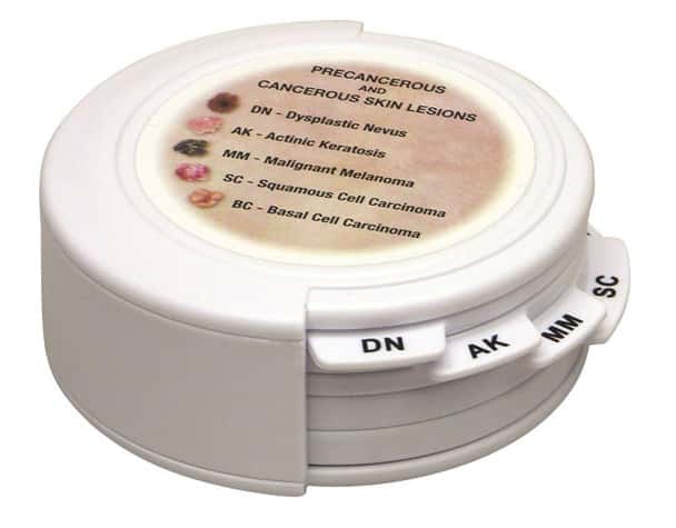 Skin Cancer Disk Set Anatomy Model