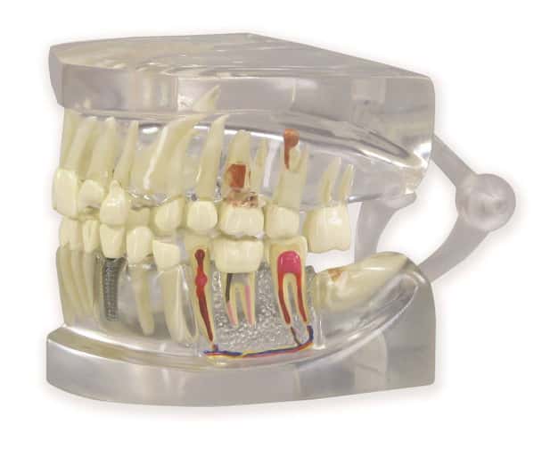 Clear Human Jaw with Teeth Anatomy Model