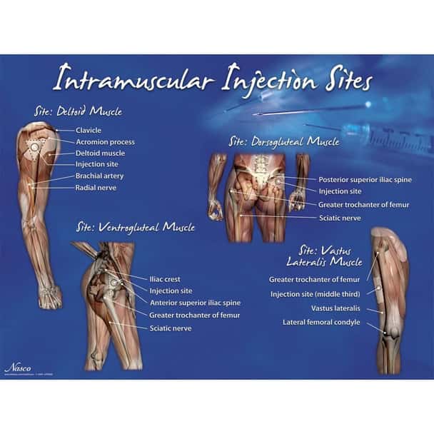 Intramuscular Injection Visual Aid Sites Set