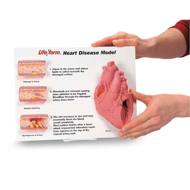 Nasco Artery/Heart Disease Display