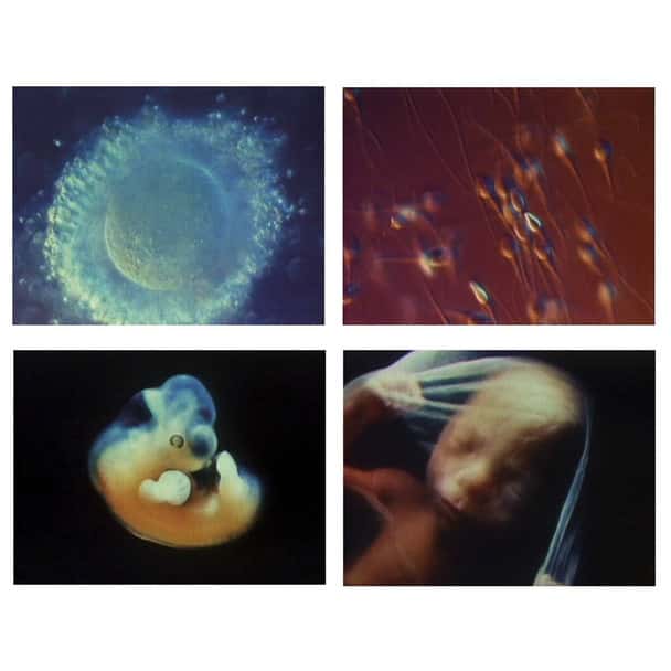 The Miracle Of Life DVD
