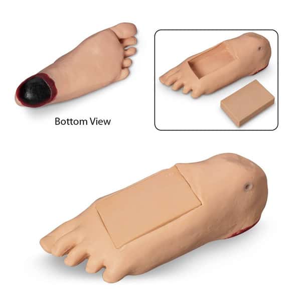 Life/form GERi and KERi Optional Edema Foot with Deep Tissue Injury - Light