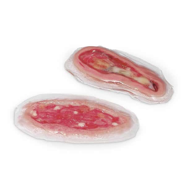 Life/form Wound - Dihiscence