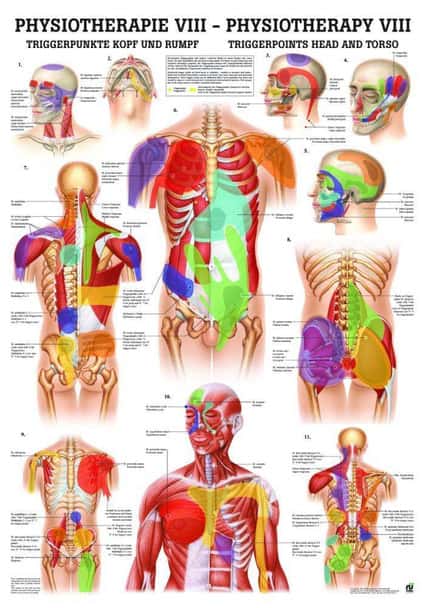 Trigger Points Head and Torso Laminated Chart