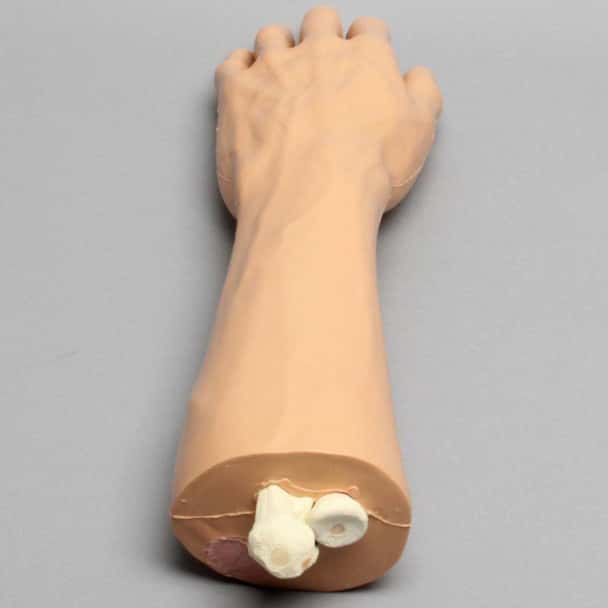 Encased Hand Wrist with Solid Foam Ulna, Radius, and Hand