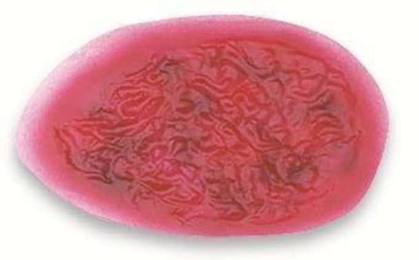 Large Sepsis Wound Stick-On
