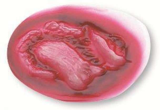 Major Avulsion Stick-On
