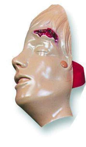 Laceration Of The Forehead Model Manikin Only