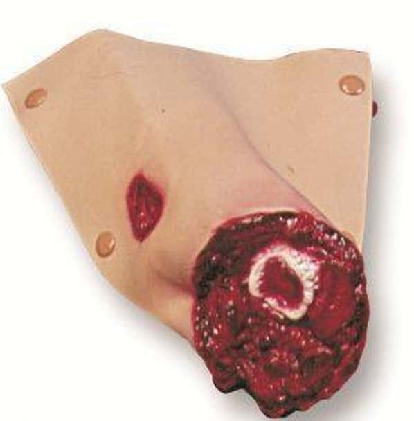 Leg Amputation Model