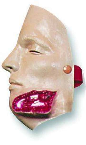Bleeding Jaw Wound Model