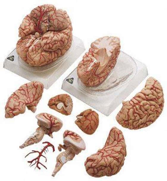 SOMSO Deluxe Brain with Arteries in 9 Parts