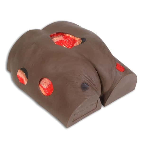 Seymour II Wound Care Model, Darkly Pigmented