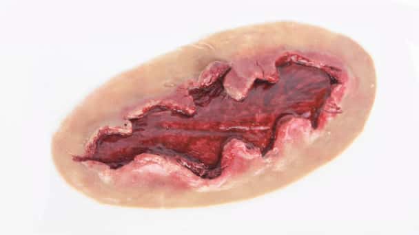 Anatomy Lab Moulage - Hemorrhaging Exposed Muscle