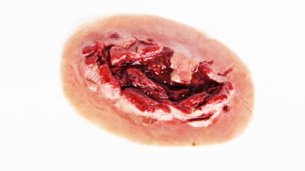 Anatomy Lab Moulage - Hemorrhaging Large Laceration