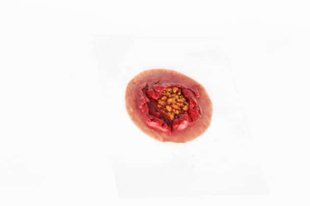 Anatomy Lab Moulage - Adipose Fatty Tissue
