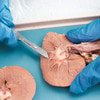 Image of the kidney being dissected in context, showing a bisected view