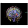 Adult Head X-Ray/CT and MRI Training Phantom Model
