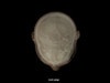 Adult Head (Openable) for X-Ray CT, US, MRI