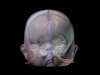 Dynamic Newborn Baby Head Phantom Model - Design