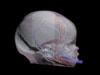 Dynamic Newborn Baby Head Phantom Model - Design