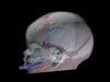 Dynamic Newborn Baby Head Phantom Model - Design