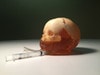 Dynamic Newborn Baby Head Phantom Model