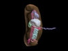 Newborn Baby Torso Phantom Model - Design
