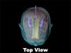 Newborn Baby Simple Head Phantom Model - Design