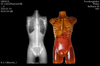 Adult Female Torso for X-Ray CT, MRI