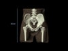 Adult Pelvis for X-Ray CT, US, MRI