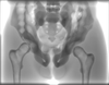 Adult Pelvis for X-Ray CT, US, MRI