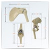 Mini Implant Joint Anatomy Model Set