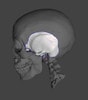 Temporal Bone Phantoms for X-Ray CT, Ultrasound, MRI