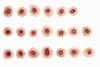 Anatomy Lab Moulage - 20 Piece Set of Gunshot Entry Wounds